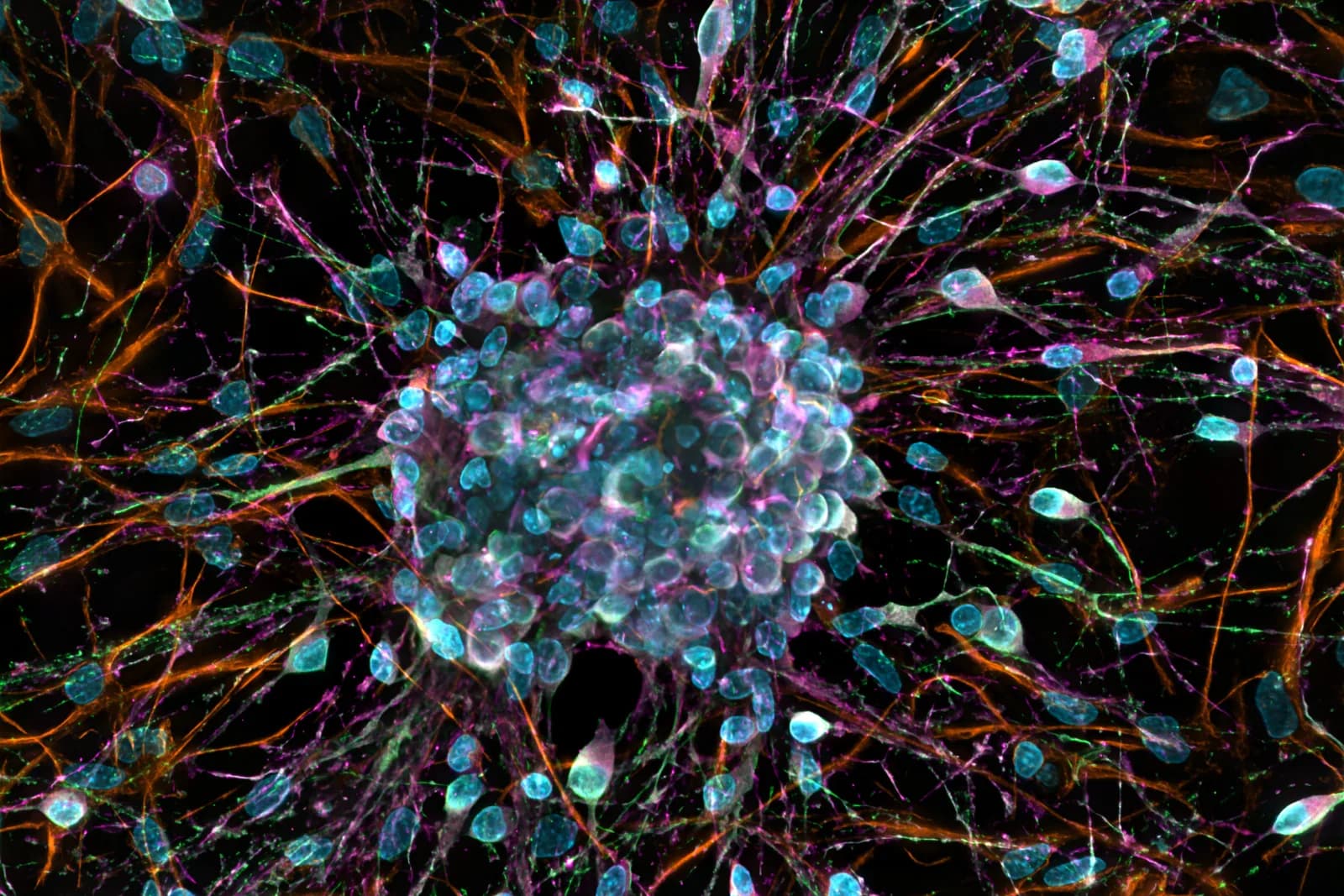 Fluorescence microscope image of rat nerve cells in culture: cell nuclei in cyan and a web of branching fibres in orange, magenta and green on a black background